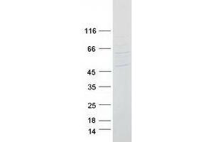 Western Blotting (WB) image for Transmembrane Phosphatase with Tensin Homology (TPTE) (Transcript Variant 2) protein (Myc-DYKDDDDK Tag) (ABIN2734106)