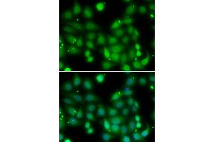 Immunofluorescence analysis of MCF-7 cells using RORA antibody (ABIN5974193). (RORA antibody)