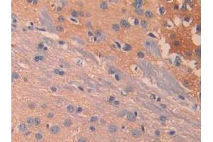 DAB staining on IHC-P; Samples: Mouse Cerebrum Tissue (IL13 Receptor alpha 1 antibody  (AA 28-171))