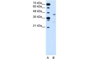 WB Suggested Anti-GPR161 Antibody Titration:  0.