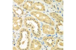 Immunohistochemistry of paraffin-embedded human kidney using RPS6KL1 antibody (ABIN5975299) at dilution of 1/100 (40x lens). (RPS6KL1 antibody)
