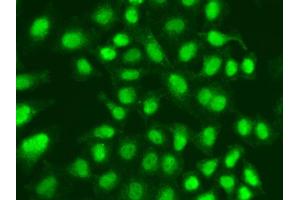 Immunofluorescence analysis of A549 cell using APTX antibody. (Aprataxin antibody)
