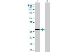 Western Blot analysis of HSD17B3 expression in transfected 293T cell line by HSD17B3 MaxPab polyclonal antibody. (HSD17B3 antibody  (AA 1-310))