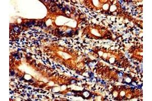 Immunohistochemistry of paraffin-embedded human small intestine tissue using ABIN7169201 at dilution of 1:100 (TLK2 antibody  (AA 23-234))
