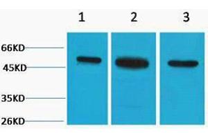 Western Blotting (WB) image for anti-Tubulin, beta 2A (TUBB2A) antibody (ABIN3178773) (TUBB2A antibody)