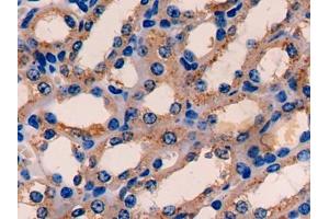 DAB staining on IHC-P; Samples: Mouse Kidney Tissue (ETFA antibody  (AA 34-295))
