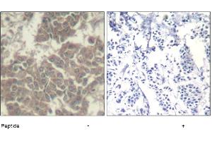 Image no. 1 for anti-Janus Kinase 2 (JAK2) (Tyr570) antibody (ABIN319397) (JAK2 antibody  (Tyr570))