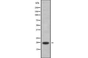Western blot analysis of MYLPF using HepG2 whole cell lysates (MYLPF antibody  (C-Term))