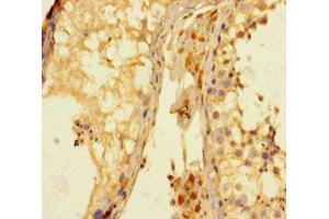 Immunohistochemistry of paraffin-embedded human testis tissue using ABIN7158695 at dilution of 1:100 (KDM4A antibody  (AA 127-364))
