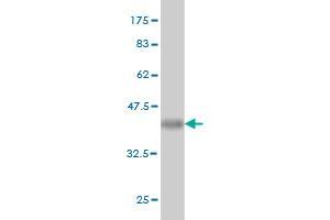 Western Blot detection against Immunogen (36. (MGAT3 antibody  (AA 430-531))