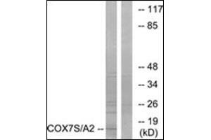 Western blot analysis of extracts from rat heart cells, using COX7S/A2 Antibody. (COX7A2 antibody  (N-Term))