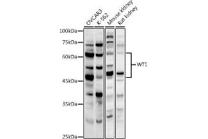 Western blot analysis of extracts of various cell lines, using WT1 antibody (ABIN3021697, ABIN3021698, ABIN3021699, ABIN1513692 and ABIN6215537) at 1:1000 dilution. (WT1 antibody  (AA 1-302))