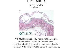 Image no. 1 for anti-Malate Dehydrogenase 1, NAD (Soluble) (MDH1) antibody (ABIN1736856) (MDH1 antibody)