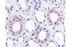 Immunohistochemistry (IHC) image for anti-Epoxide Hydrolase 2, Cytoplasmic (EPHX2) (Internal Region) antibody (ABIN2469511) (EPHX2 antibody  (Internal Region))