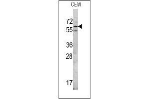 Western blot analysis of RIOK2 Center (ABIN390991 and ABIN2841174) in CEM cell line lysates (35 μg/lane). (RIOK2 antibody  (AA 270-299))