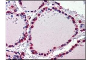 Immunohistochemistry (IHC) image for anti-Cellular Retinoic Acid Binding Protein 1 (CRABP1) (AA 1-137), (N-Term) antibody (ABIN400871) (CRABP1 antibody  (N-Term))