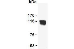 Western Blotting (WB) image for anti-Reversion-Inducing-Cysteine-Rich Protein with Kazal Motifs (RECK) (AA 621-832) antibody (ABIN1108847) (RECK antibody  (AA 621-832))