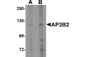 Western blot analysis of AP3B2 in rat brain tissue lysate with AP3B2 antibody at (A) 1 and (B) 2 µg/mL.