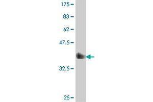 Western Blotting (WB) image for anti-Mucin 5 Subtype B (MUC5B) (AA 4186-4295) antibody (ABIN531833)