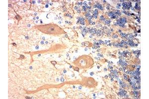 Immunohistochemical analysis of paraffin-embedded cerebellum tissues using TUBB3 mouse mAb with DAB staining. (TUBB3 antibody)