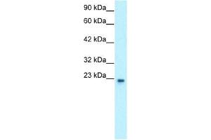Human HepG2; WB Suggested Anti-GTF2F2 Antibody Titration: 0. (GTF2F2 antibody  (Middle Region))