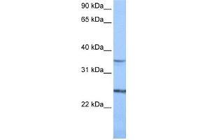 WB Suggested Anti-PIGF Antibody Titration:  0. (PIGF antibody  (N-Term))