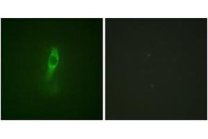 Immunofluorescence analysis of NIH-3T3 cells, using ETK (Phospho-Tyr40) Antibody. (BMX antibody  (pTyr40))