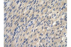 Rabbit Anti-TRIantibody        Paraffin Embedded Tissue:  Human Heart cell   Cellular Data:  Epithelial cells of renal tubule  Antibody Concentration:   4. (TRIP13 antibody  (N-Term))