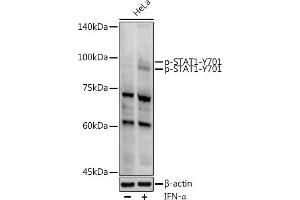 Western blot analysis of extracts of HeLa cells, using Phospho-ST-Y701 antibody (ABIN3019607, ABIN3019608, ABIN3019609 and ABIN1682075) at 1:1000 dilution. (STAT1 antibody  (pTyr701))