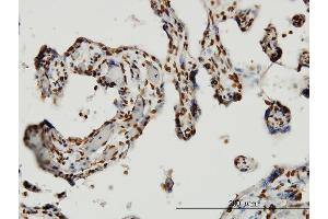 Immunoperoxidase of monoclonal antibody to HMGB1 on formalin-fixed paraffin-embedded human placenta. (HMGB1 antibody  (AA 1-90))