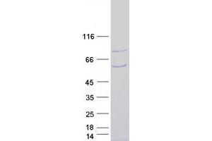 Validation with Western Blot (SMURF1 Protein (Transcript Variant 2) (Myc-DYKDDDDK Tag))