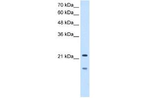 WB Suggested Anti-MMP7 Antibody Titration:  2. (MMP7 antibody  (C-Term))