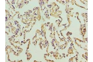 Immunohistochemistry of paraffin-embedded human lung tissue using ABIN7164085 at dilution of 1:100 (PRDM14 antibody  (AA 301-571))