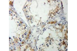 IHC-P analysis of Testis tissue, with DAB staining. (RASA1 antibody  (AA 403-596))