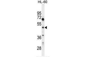CEPT1 Antibody (N-term) western blot analysis in HL60 cell line lysates (35µg/lane). (CEPT1 antibody  (N-Term))