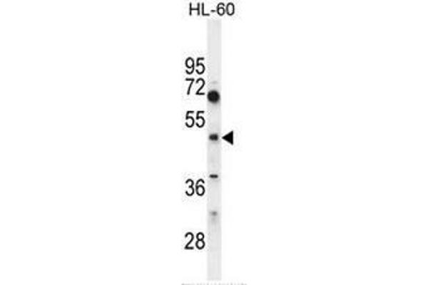CEPT1 antibody  (N-Term)