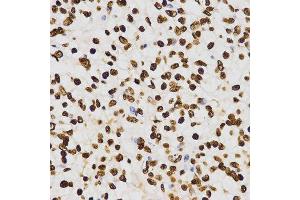 Immunohistochemistry (IHC) image for anti-Histone H3 (H3) (H3K27me) antibody (ABIN3023266) (Histone 3 antibody  (H3K27me))