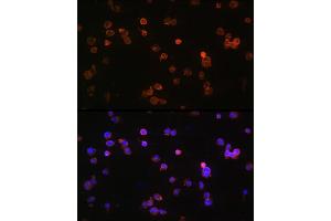 Immunofluorescence analysis of Jurkat cells using P2RX5 Rabbit pAb (ABIN6132450, ABIN6145117, ABIN6145118 and ABIN6215403) at dilution of 1:100 (40x lens). (P2RX5 antibody  (AA 341-422))