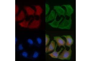 ABIN6256942 and ABIN6276055 staining Hela cells by IF/ICC.