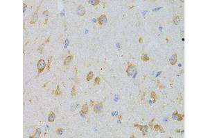 Immunohistochemistry of paraffin-embedded Mouse brain using KISS1R Polyclonal Antibody at dilution of 1:100 (40x lens). (KISS1R antibody)