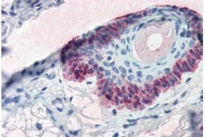 Human Skin, Hair Follicle (formalin-fixed, paraffin-embedded) stained with KRT15 antibody ABIN334263 at 5 ug/ml followed by biotinylated anti-mouse IgG secondary antibody ABIN481714, alkaline phosphatase-streptavidin and chromogen. (KRT15 antibody  (C-Term))