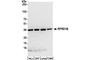 Western Blotting (WB) image for anti-Regulation of Nuclear Pre-mRNA Domain Containing 1B (RPRD1B) (AA 276-326) antibody (ABIN7452017)