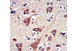|Immunohistochemistry of paraffin-embedded human brain cancer tissue using GSNantibody.