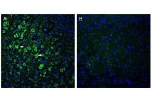 Expression of ADAM10 in mouse parietal cortex. (ADAM10 antibody  (Extracellular, N-Term))