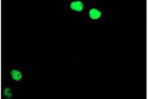 Image no. 3 for anti-T-Cell Acute Lymphocytic Leukemia 1 (TAL1) antibody (ABIN1501289) (TAL1 antibody)