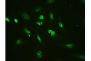 IF analysis of HMGB2 using anti-HMGB2 antibody (ABIN4886620). (HMGB2 antibody  (N-Term))