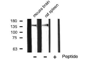 Western blot analysis of VEGFR1 expression in mouse brain and rat spleen tissue lysates,The lane on the right is treated with the antigen-specific peptide. (FLT1 antibody)