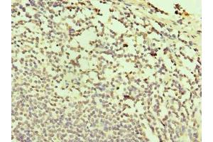 Immunohistochemistry of paraffin-embedded human small intestine tissue using ABIN7171996 at dilution of 1:100 (TXNDC11 antibody  (AA 656-985))
