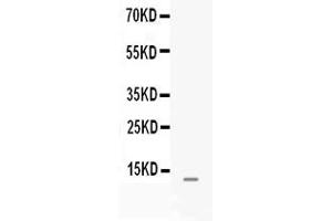 Western blot analysis of MGP expression in JURKAT whole cell lysates ( Lane 1). (MGP antibody  (AA 20-96))