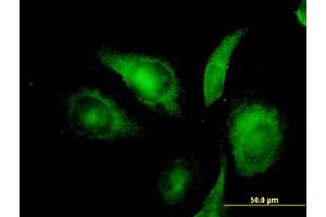Immunofluorescence of monoclonal antibody to NIFUN on HeLa cell. (ISCU antibody  (AA 26-167))